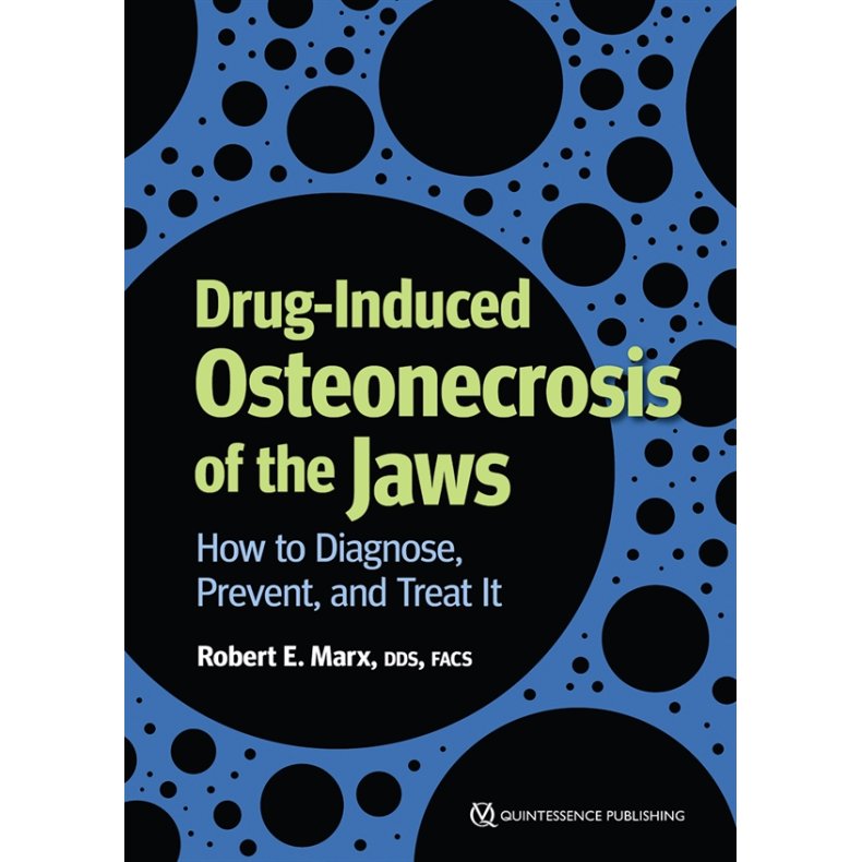Drug-Induced Osteonecrosis of the Jaws